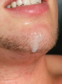 Randall's facial